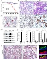 SFTPB Precursor Antibody in Immunohistochemistry (IHC)