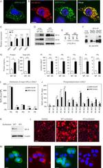 SFTPB Precursor Antibody in Western Blot (WB)
