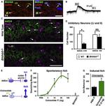 PAX2 Antibody in Immunohistochemistry (IHC)
