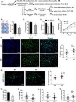 MYOD Antibody in Immunohistochemistry, Immunocytochemistry (IHC, ICC/IF)