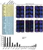 GFP Antibody in Immunocytochemistry (ICC/IF)