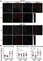 Hepatitis C Virus Core Antigen Antibody in Immunohistochemistry, Immunocytochemistry (IHC, ICC/IF)