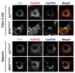 Hepatitis C Virus Core Antigen Antibody in Immunomicroscopy (IM)