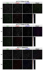 Hepatitis C Virus Core Antigen Antibody in Immunohistochemistry, Immunocytochemistry (IHC, ICC/IF)