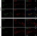 HuC/HuD Antibody in Immunohistochemistry (IHC)