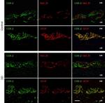 HuC/HuD Antibody in Immunohistochemistry (IHC)