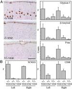Phospho-Tau (Thr181) Antibody in Immunohistochemistry (IHC)