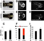HuC/HuD Antibody in Immunohistochemistry (IHC)