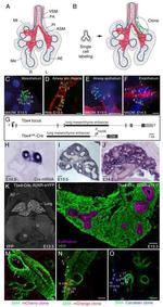 E-cadherin Antibody in Immunohistochemistry (IHC)