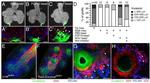 E-cadherin Antibody in Immunohistochemistry (IHC)
