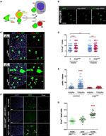GFP Antibody in Immunohistochemistry, Immunocytochemistry (IHC, ICC/IF)