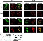 Hepatitis C Virus Core Antigen Antibody in Immunomicroscopy (IM)