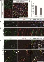 CD140a (PDGFRA) Antibody in Immunohistochemistry, Immunocytochemistry (IHC, ICC/IF)