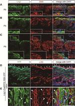 c-Kit Antibody in Immunohistochemistry, Immunocytochemistry (IHC, ICC/IF)