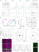 GFP Antibody in Immunocytochemistry (ICC/IF)
