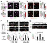 PSD-95 Antibody in Immunohistochemistry (IHC)