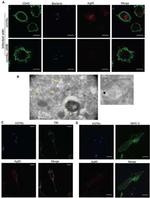 Transferrin Receptor Antibody in Immunocytochemistry (ICC/IF)
