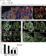 E-cadherin Antibody in Immunohistochemistry (IHC)