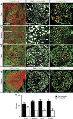 E-cadherin Antibody in Immunohistochemistry (IHC)