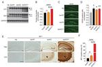 Tau Antibody in Western Blot (WB)