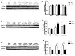 SLC27A6 Antibody in Western Blot (WB)