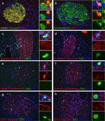 E-cadherin Antibody in Immunohistochemistry (Paraffin) (IHC (P))