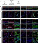 Cytokeratin 13 Monoclonal Antibody (2D7)