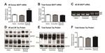 Tau Antibody in Western Blot (WB)