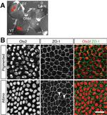 ZO-1 Antibody in Immunohistochemistry (IHC)