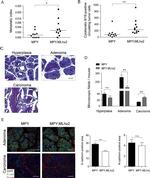 N-cadherin Antibody in Immunohistochemistry (IHC)