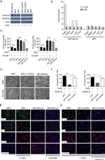 E-cadherin Antibody in Immunohistochemistry, Immunocytochemistry (IHC, ICC/IF)