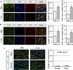 Ki-67 Antibody in Immunohistochemistry (IHC)
