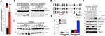 FOXO6 Antibody in Western Blot, ChIP Assay (WB, ChIP)