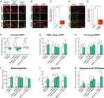 GABRB3 Antibody in Immunohistochemistry, Immunocytochemistry (IHC, ICC/IF)
