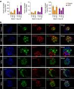 GLUT1 Antibody in Immunocytochemistry (ICC/IF)