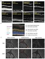 CHX10 Antibody in Immunomicroscopy (IM)