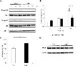 Phospho-FAK (Tyr397) Antibody in Western Blot (WB)