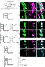 GFAP Antibody in Immunohistochemistry (IHC)