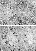 CD4 Antibody in Immunohistochemistry (IHC)