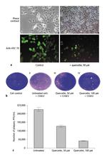 HSC70 Antibody in Immunohistochemistry, Immunocytochemistry (IHC, ICC/IF)
