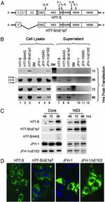 Hepatitis C Virus Core Antigen Antibody in Western Blot (WB)