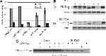 Hepatitis C Virus Core Antigen Antibody in Western Blot (WB)