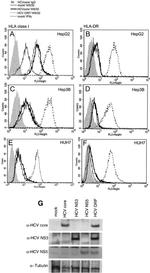 Hepatitis C Virus Core Antigen Antibody in Western Blot (WB)