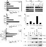 Hepatitis C Virus Core Antigen Antibody in Western Blot (WB)