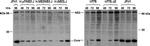 Hepatitis C Virus Core Antigen Antibody in Western Blot (WB)