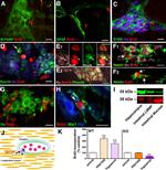 HuC/HuD Antibody in Immunohistochemistry, Immunocytochemistry (IHC, ICC/IF)