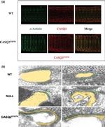 Calsequestrin Antibody in Immunohistochemistry, Immunocytochemistry (IHC, ICC/IF)