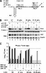Hepatitis C Virus Core Antigen Antibody in Western Blot (WB)