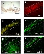 Estrogen Receptor beta Antibody in Immunohistochemistry, Immunocytochemistry (IHC, ICC/IF)