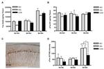 Phospho-Tau (Thr231) Antibody in Immunohistochemistry (IHC)